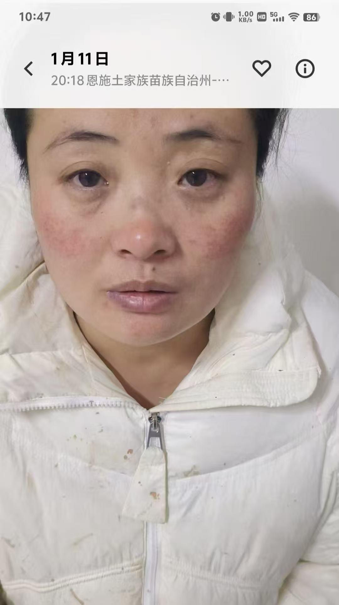 被家暴13年后失禁患癌，她将丈夫送上法庭，丈夫回应：家暴指控片面，不属实
